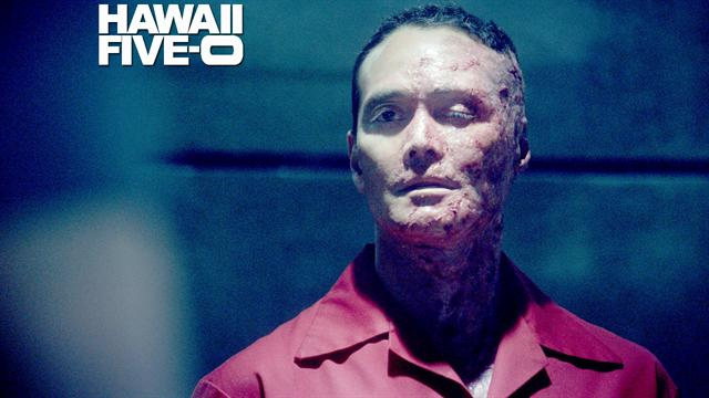 Hawaii Five-0 - Prescription For Pain