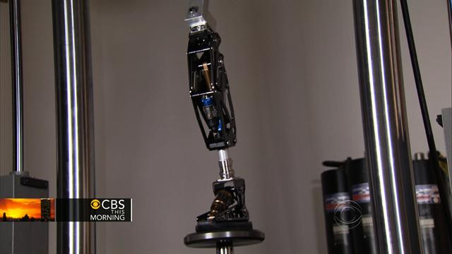 Athlete-amputee becomes artificial limb inventor