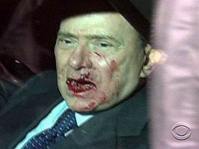 Berlusconi Attacked