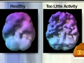 Brain Boosting Changes Body