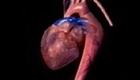 Ritter Rules for Aortic Diseases