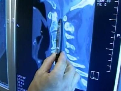 Shoulder Pain May Be A Sign