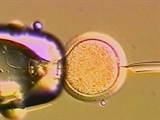 New Stem Cell Breakthrough