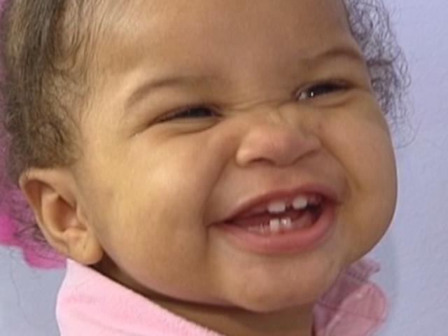 Early Signs Of Child Obesity