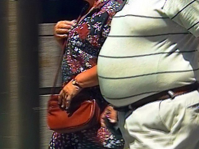 Tackling U.S. Obesity