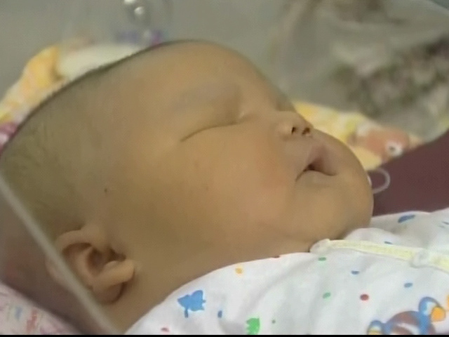 The 19 Pound Newborn
