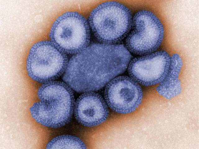 Unplugged: H1N1 Cases Overestimated?