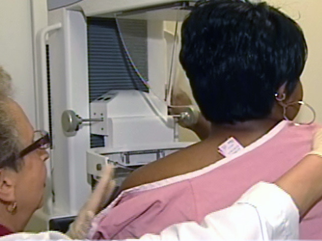 Mammogram Guideline Reversal?