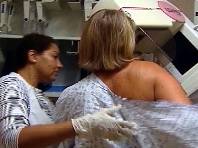 Questioning The Mammography Debate