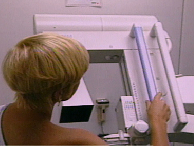 Mammogram Alternatives