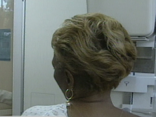 Confusing Mammogram Guidelines