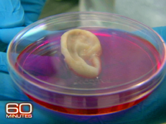 Preview: Growing Body Parts