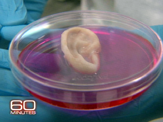 Web Extra: Growing an Ear
