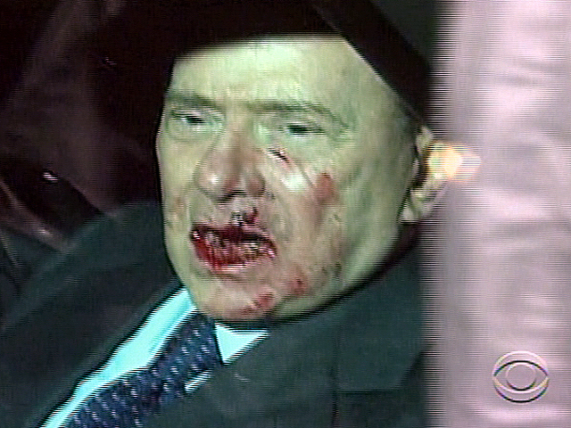 Berlusconi Attacked
