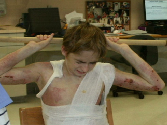 Michael Brewer Sent Home