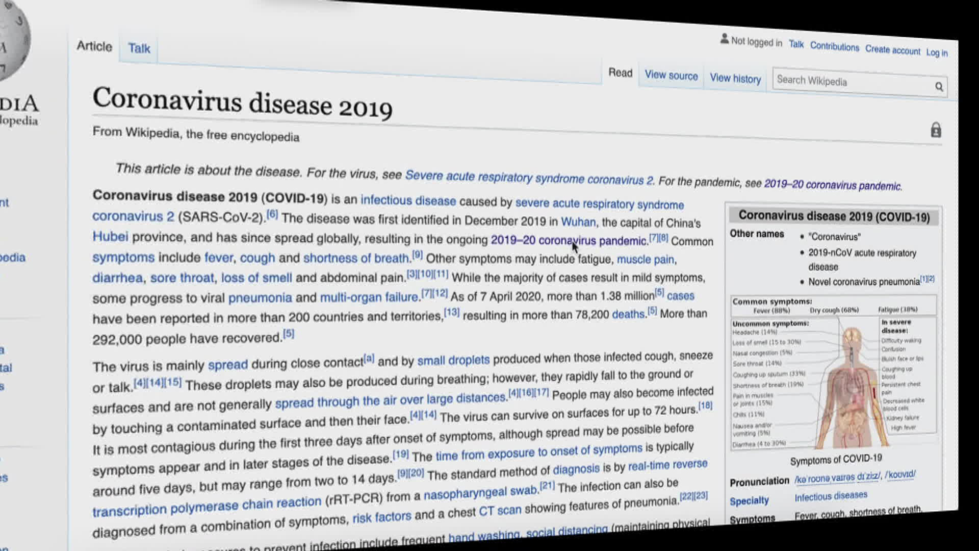 Sinus paranasal — Wikipédia