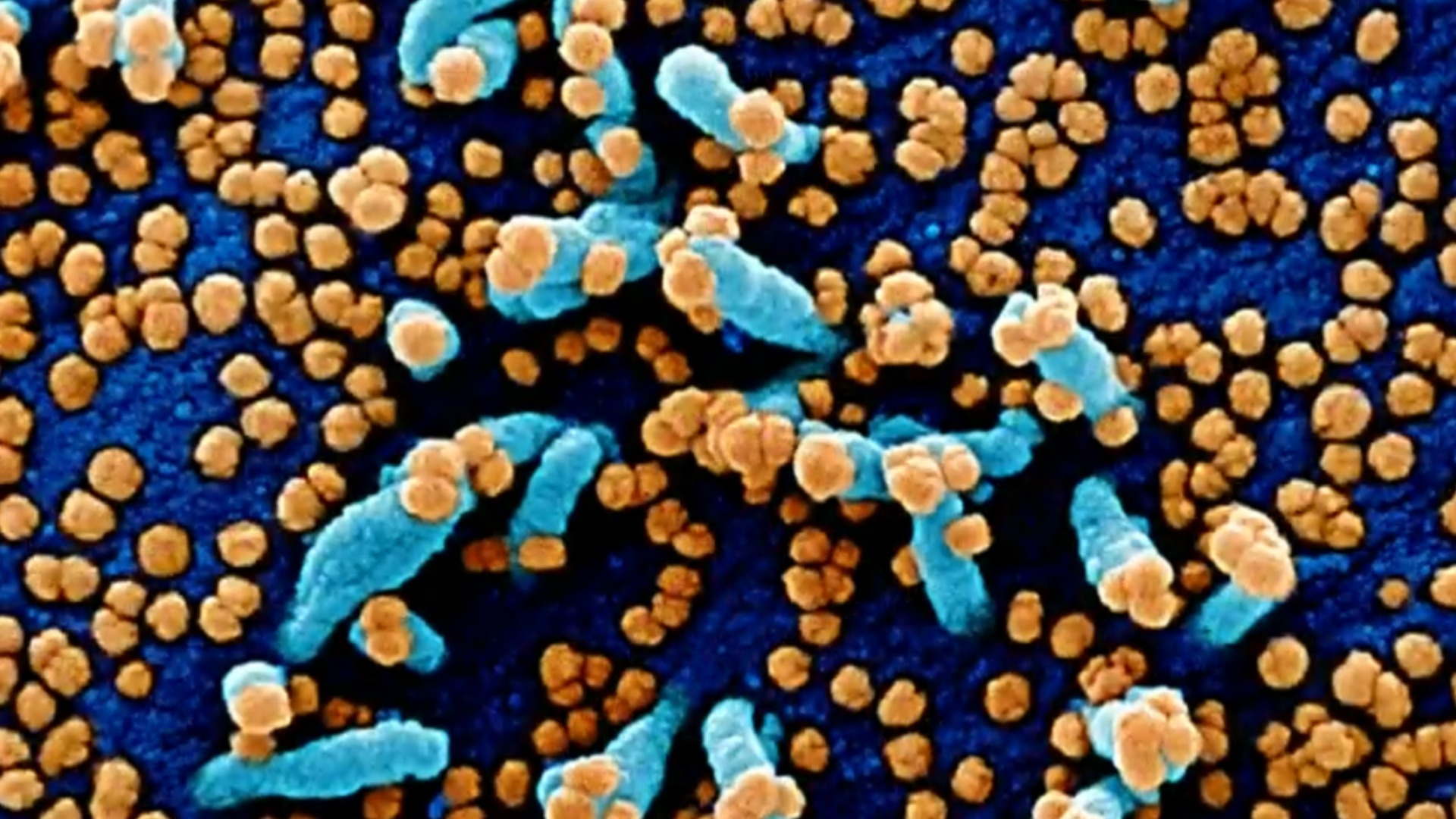 Watch CBS Evening News More cases of Omicron variant detected in U.S