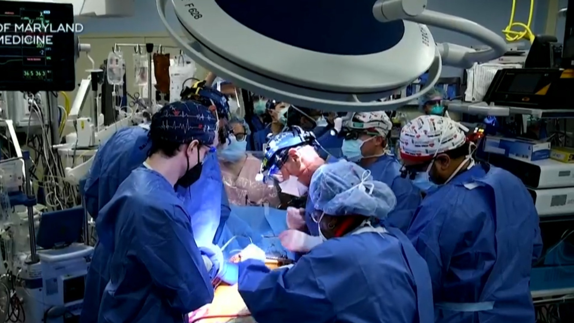 Watch CBS Evening News Doctors transplant pig heart into human Full