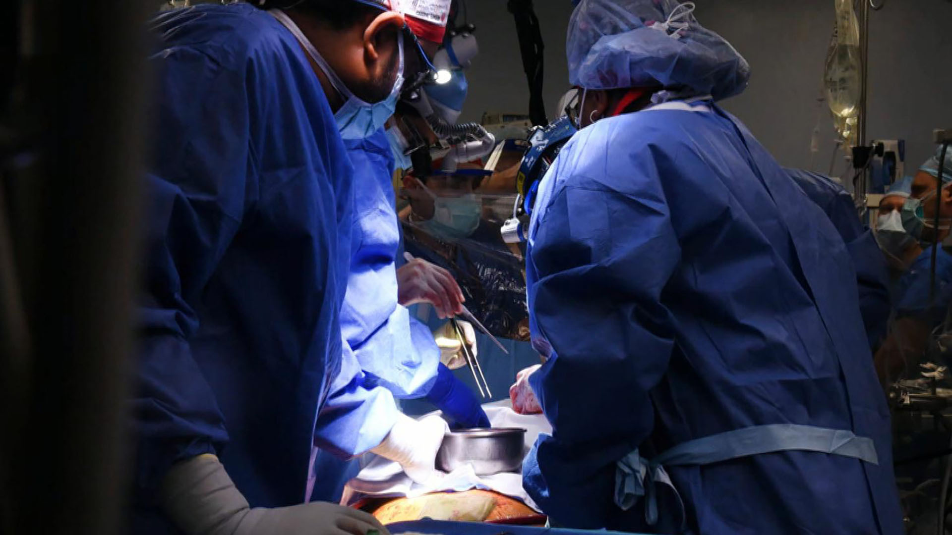Watch CBS Mornings Surgeons transplant pig heart into human Full