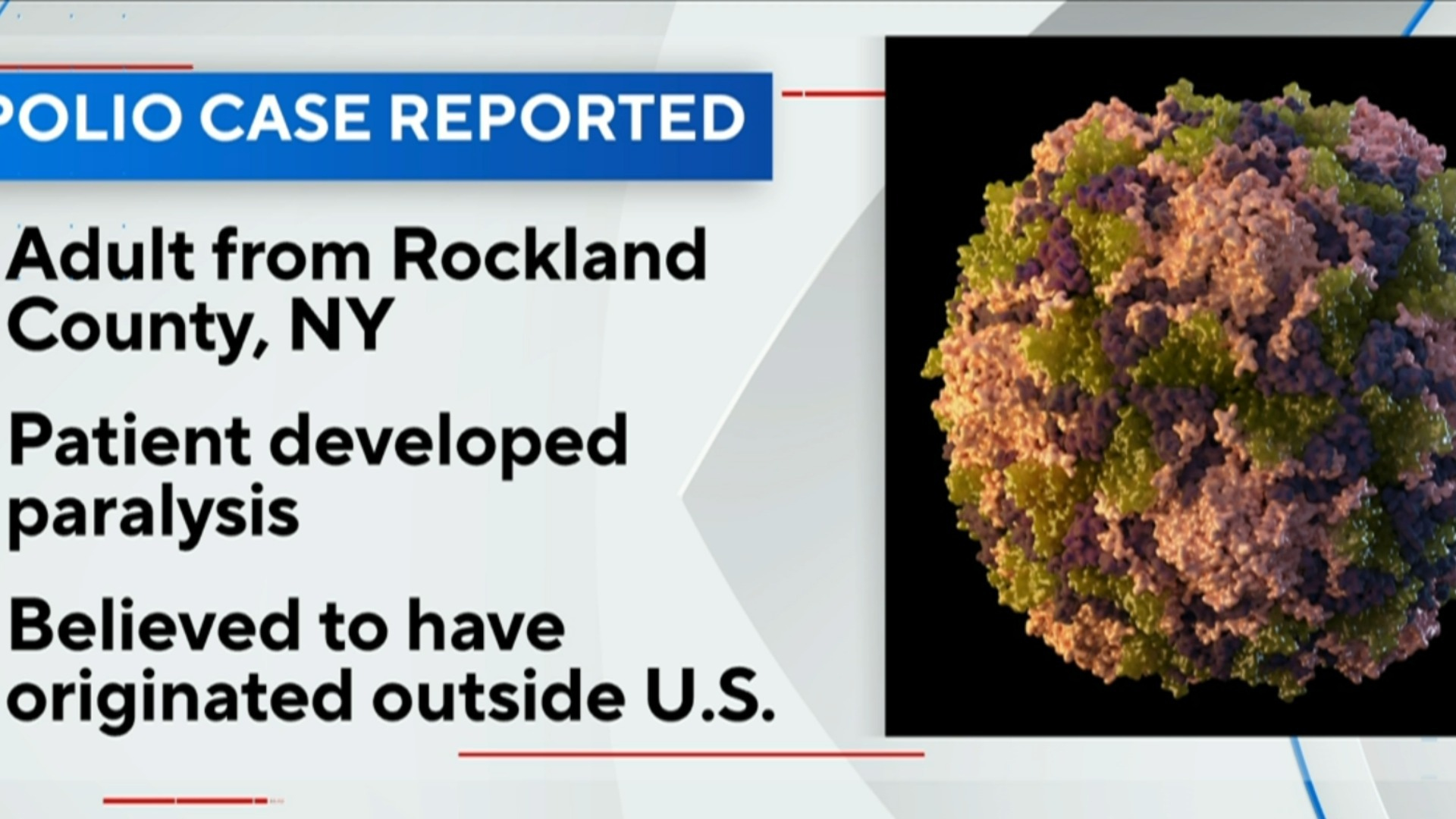 Watch CBS Evening News New York reports first U.S. polio case since 2013 Full show on CBS