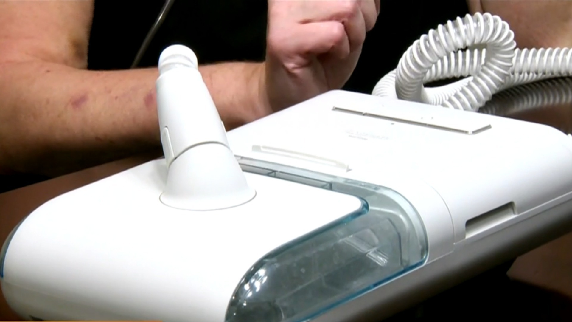 Watch CBS Evening News Sleep apnea sufferers still hurt by CPAP recall