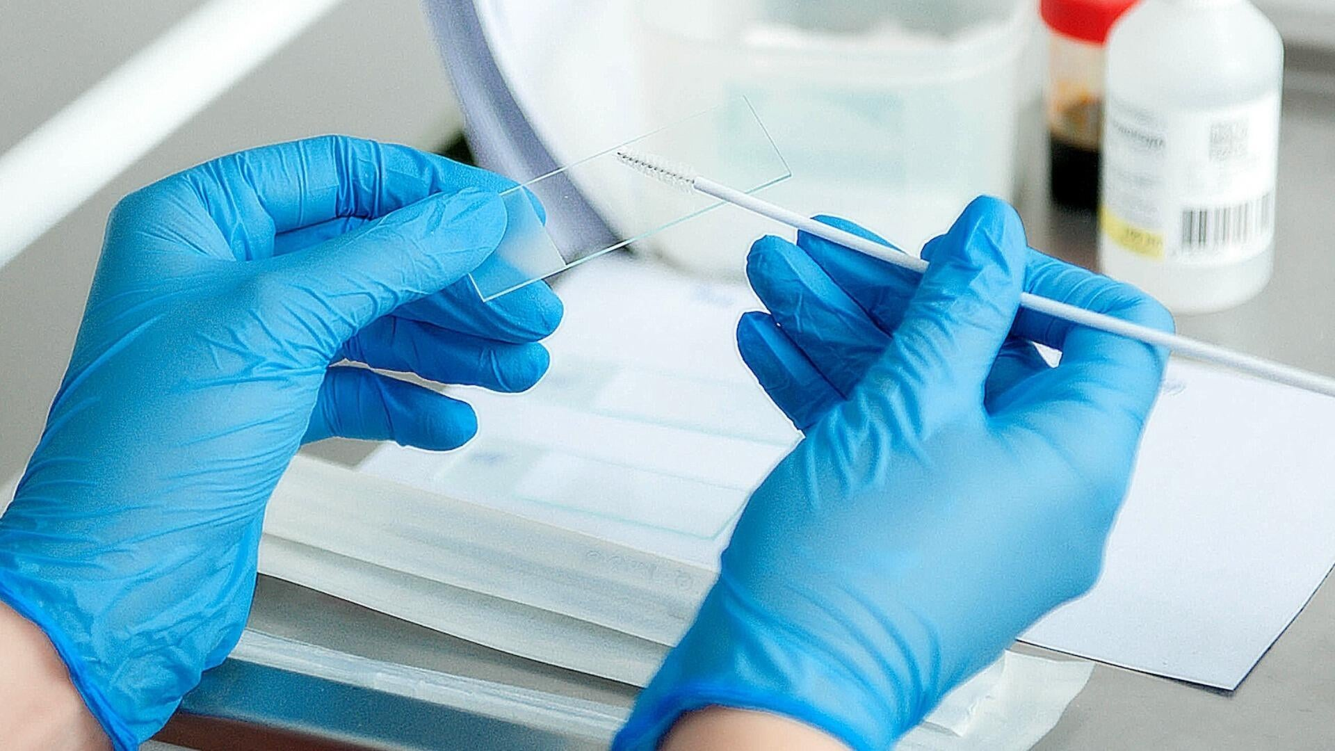 Watch CBS Mornings Cervical cancer screening guidelines updated ...