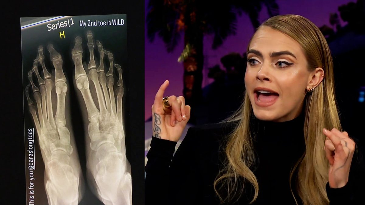 Watch The Late Late Show with James Corden Cara Delevingne Sent XRays