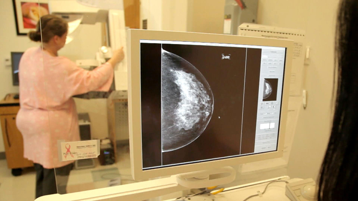 Watch Cbs Evening News New Guidelines For Mammograms Full Show On Cbs All Access