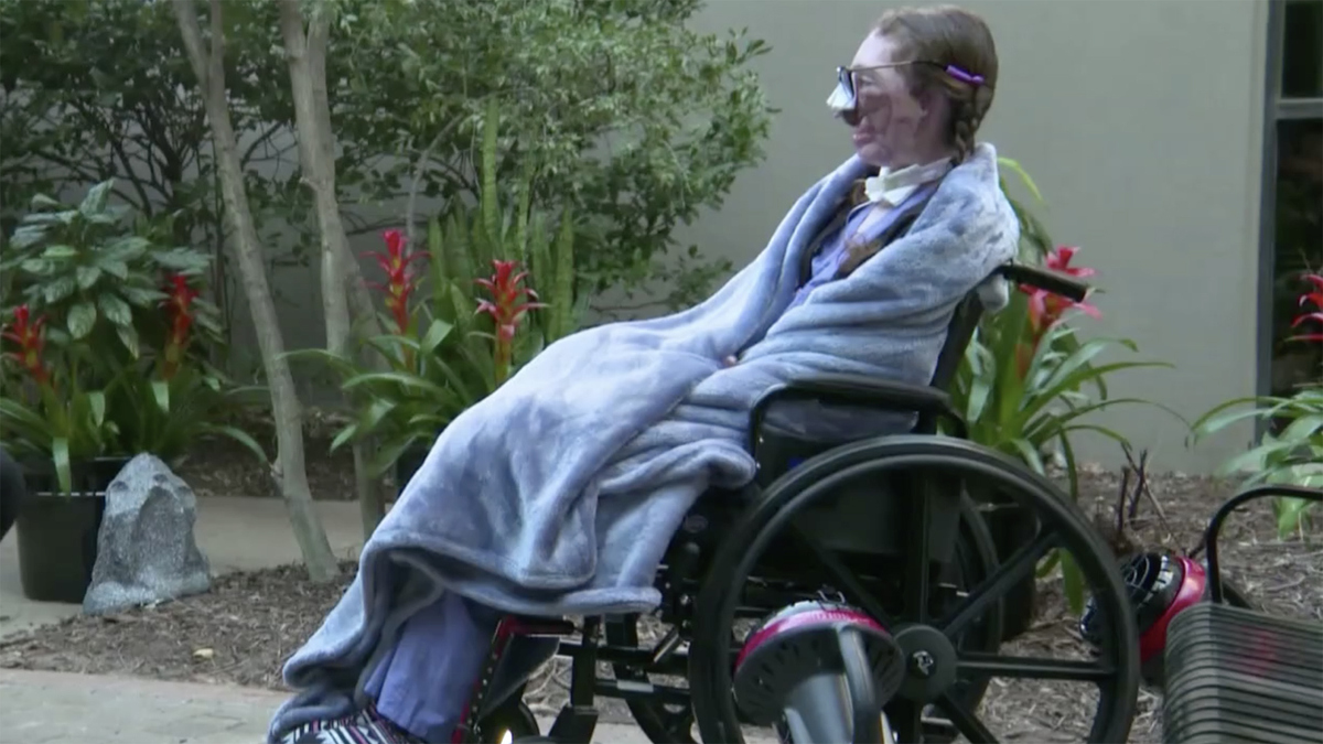 Watch CBS Mornings Dog sitter recovering after dog attack Full show(01)