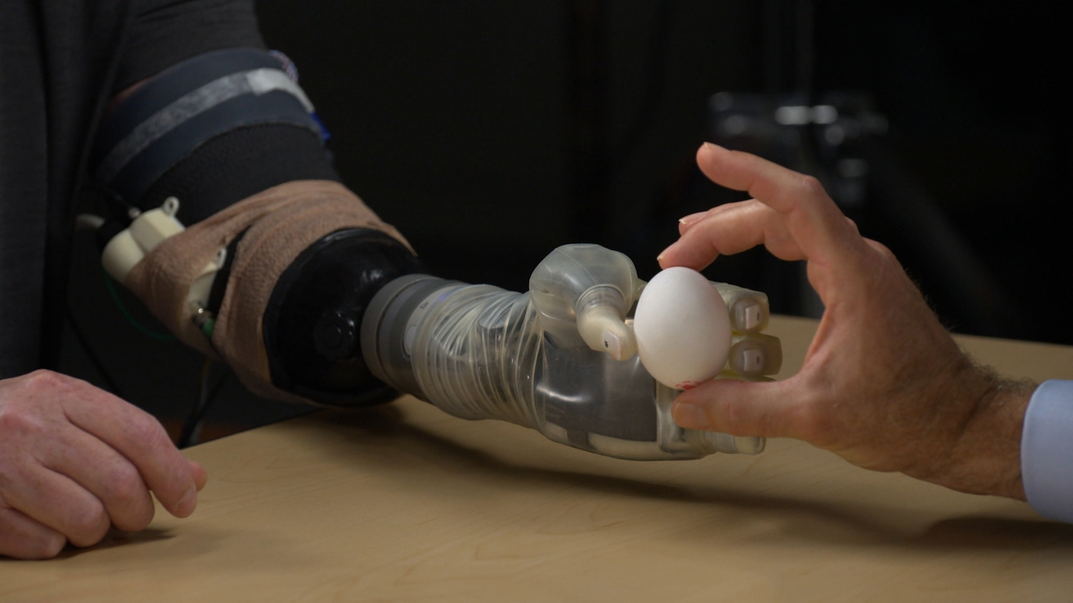 Watch 60 Minutes: Prosthetic tech advances give sense of touch - Full ...