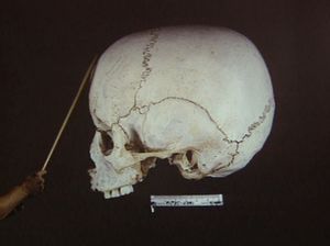 Forensic Files - Knot for Everyone
