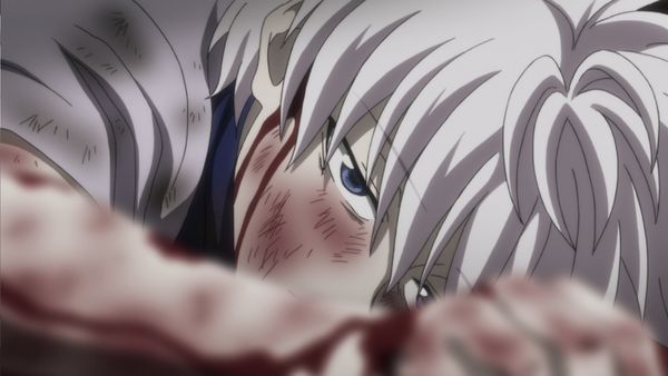 HUNTERxHUNTER - Ikalgo x And x Lightning