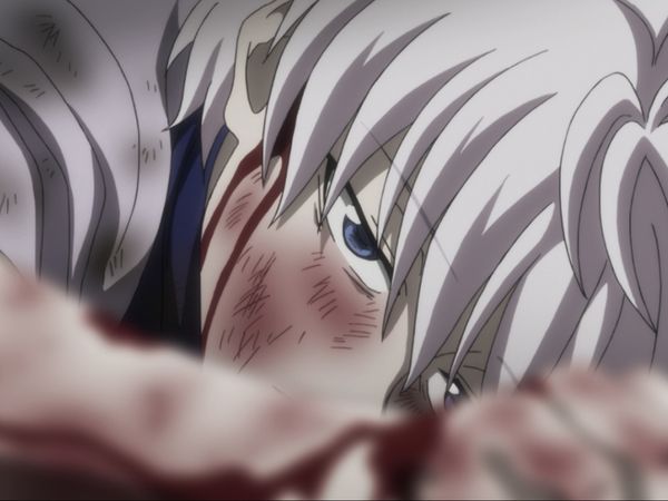 HUNTERxHUNTER - Ikalgo x And x Lightning