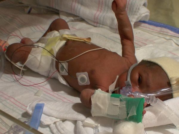 Special Delivery: Baby ER - Special Delivery Baby ER