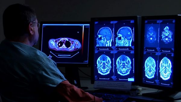 Xploration Outer Space - Astronaut Health