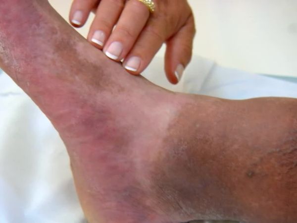 Embarrassing Bodies - Caerphilly,Gales