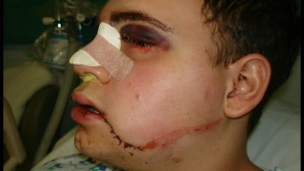 Amazing Lives - Reconstruct My Face