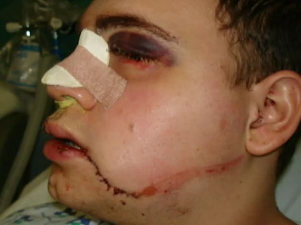 Amazing Lives - Reconstruct My Face