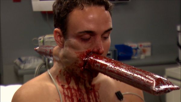 Untold Stories of the ER - Pipe In Head