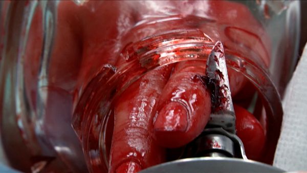 Untold Stories of the ER - Twist & Shout