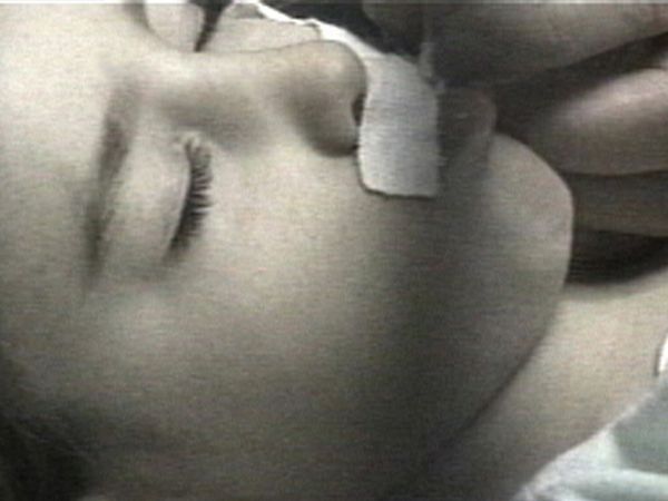 Miracle Babies - Episode 3