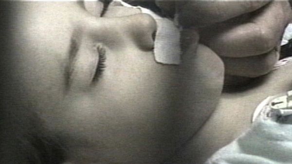 Miracle Babies - Episode 3