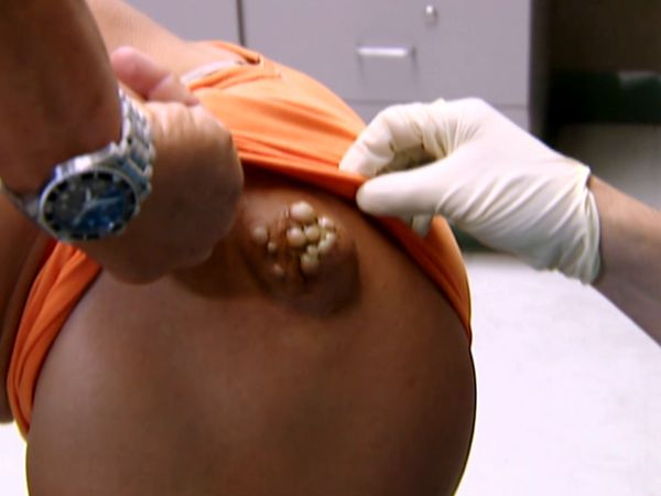 Pronto-Socorro: Histórias de Emergência - Episódio 17