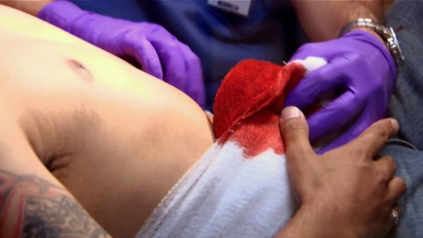 Untold Stories of the ER - Liver Die