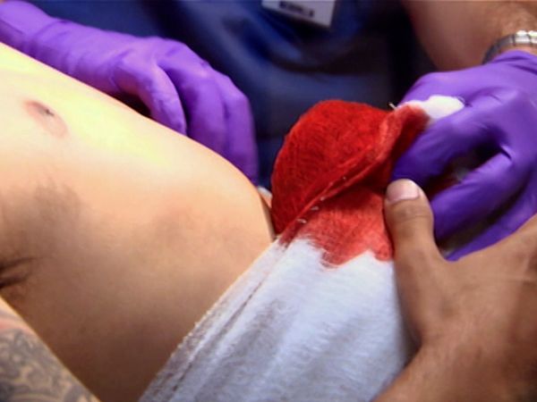 Untold Stories of the ER - Liver Die