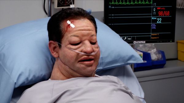 Untold Stories of the ER - Beyond Recognition