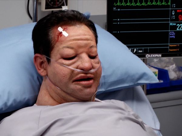 Untold Stories of the ER - Beyond Recognition