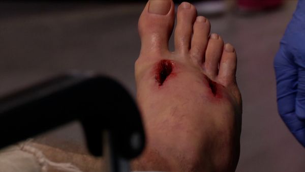 Untold Stories of the ER - Medieval Mayhem