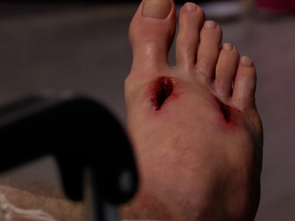 Untold Stories of the ER - Medieval Mayhem