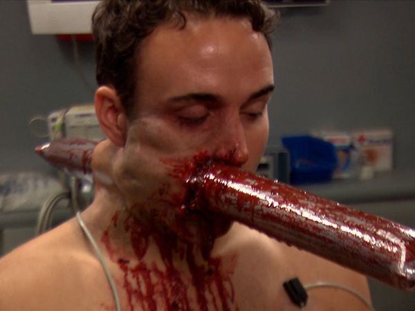 Untold Stories of the ER - Pipe In Head